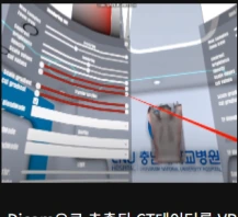 CT 데이터 VR 뷰어 · 프로젝트 이미지